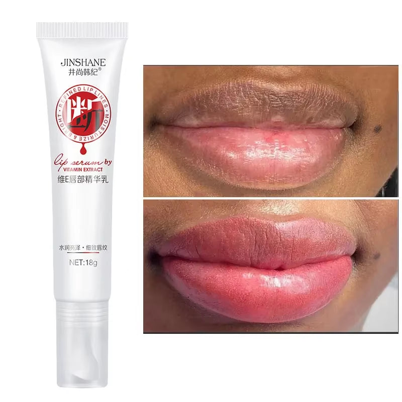 Lips Pink Fresh Lightening Bleaching Cream Treatment Remove Dark Smoke Lips Lip Balm Whitening Moisturizer Nourishing Essence